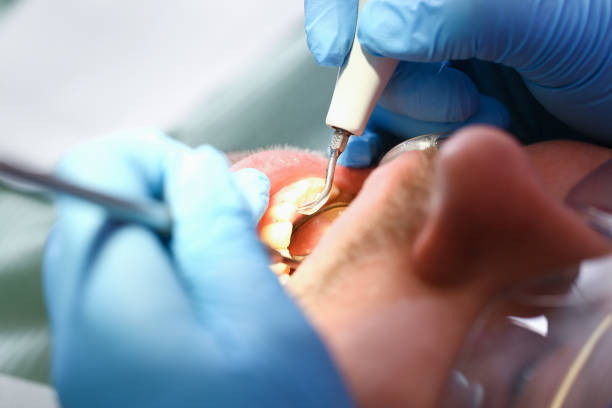 Dentist for Dental Trauma in NJ